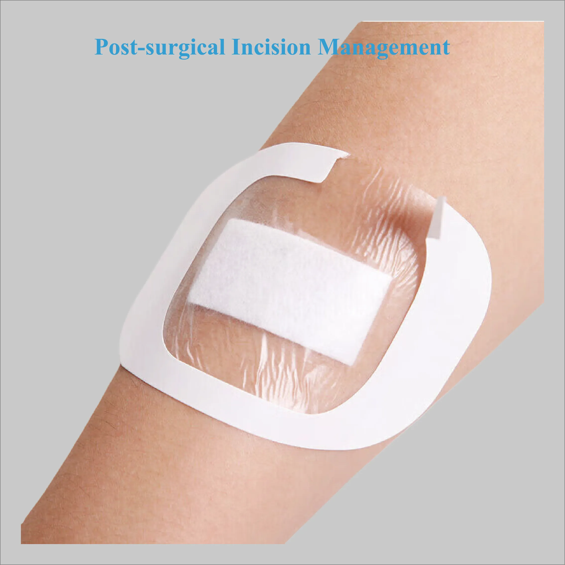 समुद्री शैवाल फाइबर सुई के अनुप्रयोग