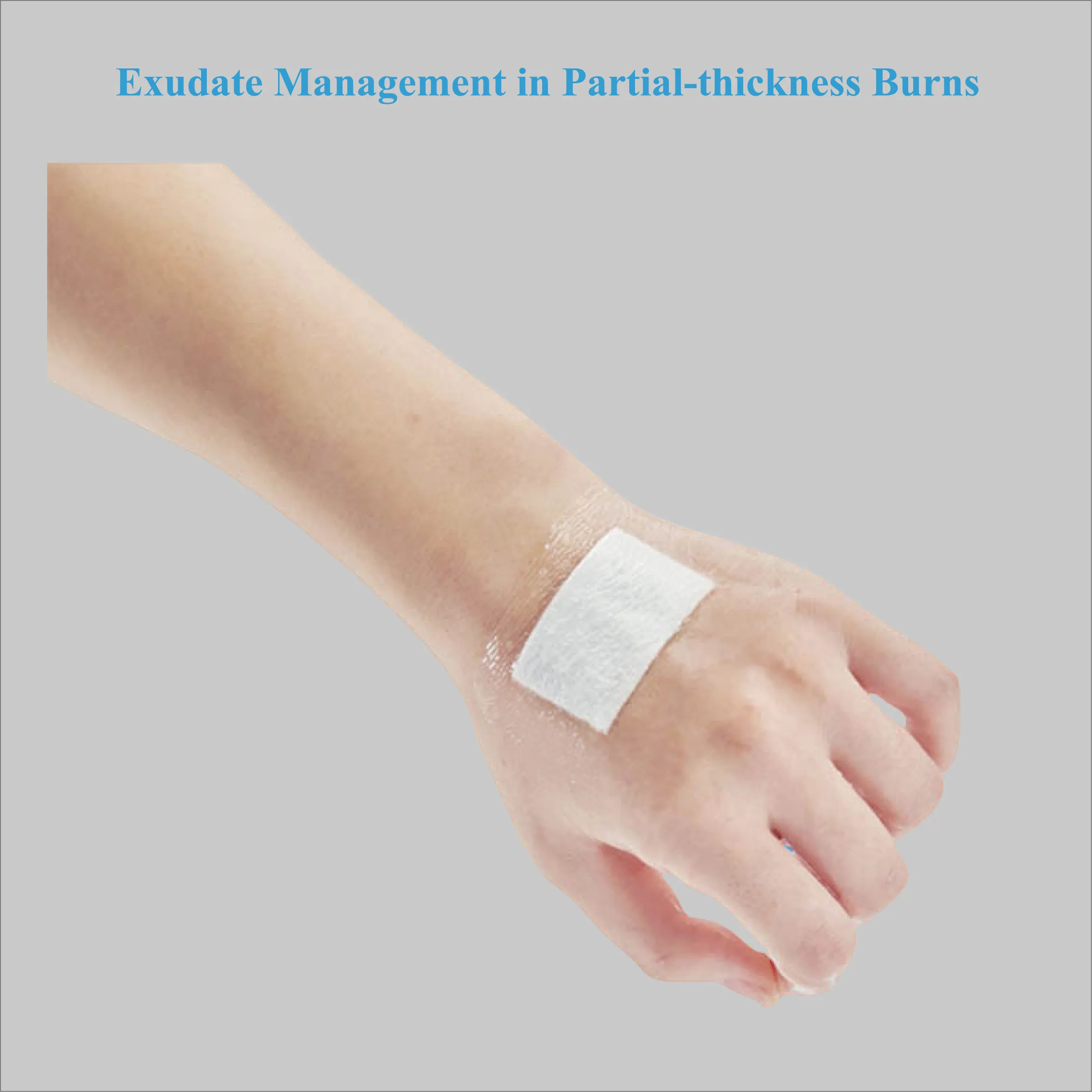 समुद्री शैवाल फाइबर सुई के अनुप्रयोग